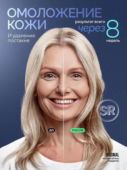 Gutsy Фотоэпилятор профессиональный лазерный мощный 22-24 Дж, 22-24, фото 5