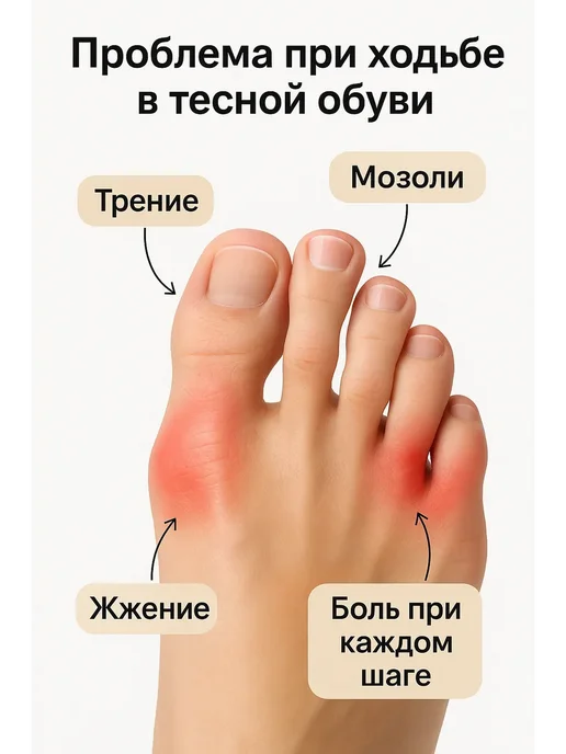 ВелЛуна Силиконовые защитные напальчники для пальцев ног от мозолей, 5 шт, фото 2