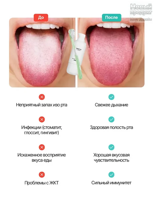 EMRA Скребок щетка для языка(высокое качество), голубой, фото 7