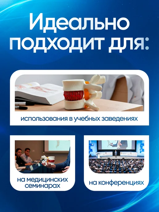 Дек Медицинский макет грыжи поясничного отдела, вариант, фото 2
