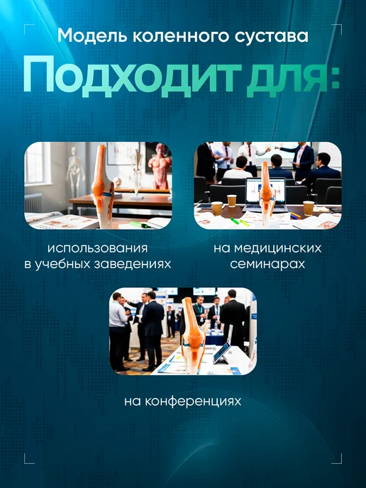 Дек Анатомическая модель коленного сустава человека Corpo Knee, вариант, фото 2