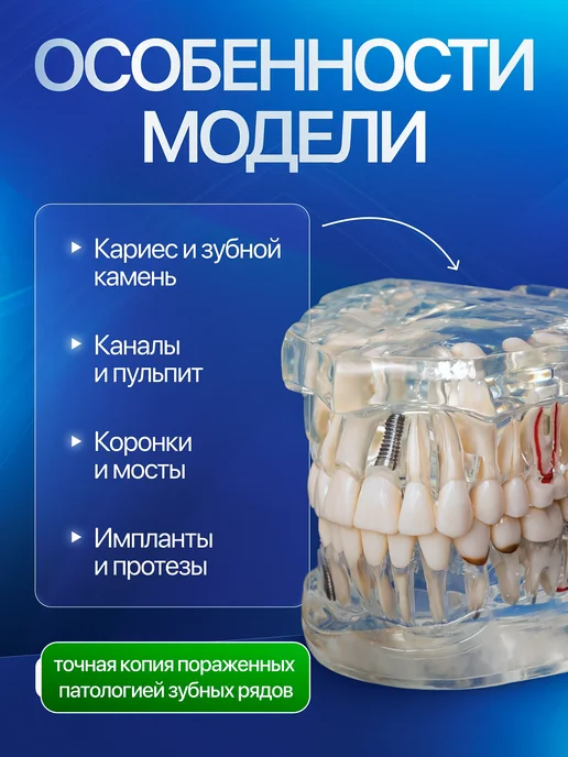 Дек Анатомический макет челюсти человека, вариант, фото 3
