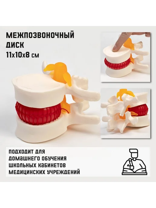 Simaland Анатомическая модель Макет межпозвонкового диска, вариант