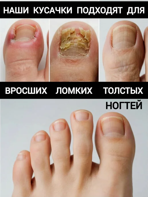 Danay Кусачки педикюрные для ногтей вросших грубых щипчики щипцы, вариант, фото 5