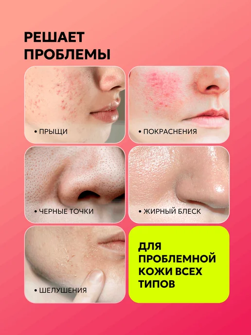 БьютиЦевтика Салициловый тоник для лица против прыщей с цинком и серебром, серебристый, фото 2