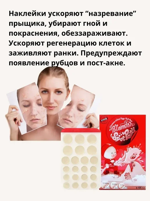 KateLove Маскирующие пластыри от прыщей кружочки наклейки бежевые, бежевый, фото 2