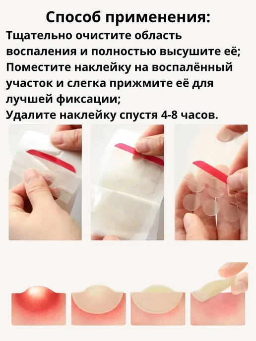 KateLove Маскирующие пластыри от прыщей кружочки наклейки бежевые, бежевый, фото 5