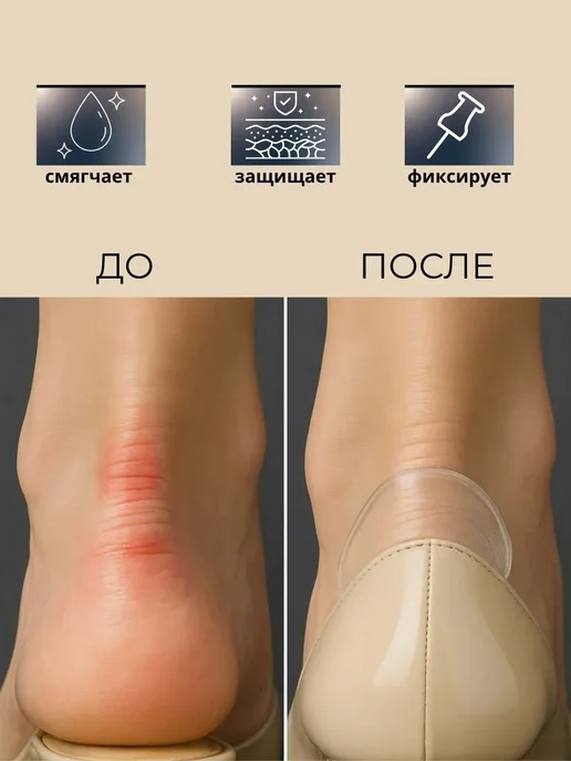 noore Силиконовые гелевые накладки для защиты пяток, 2 шт, фото 2