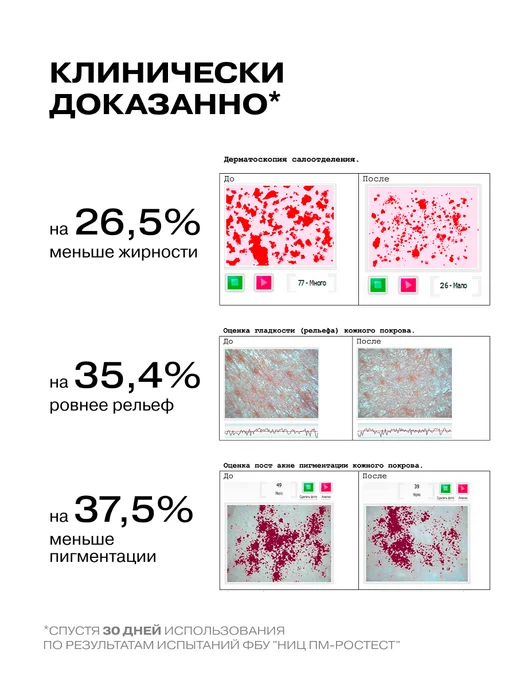 Openface Гель для душа с 5% кислот Shower Power, 400мл, 400 мл, фото 3