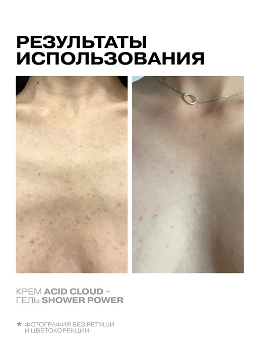 Openface Гель для душа с 5% кислот Shower Power, 400мл, 400 мл, фото 6
