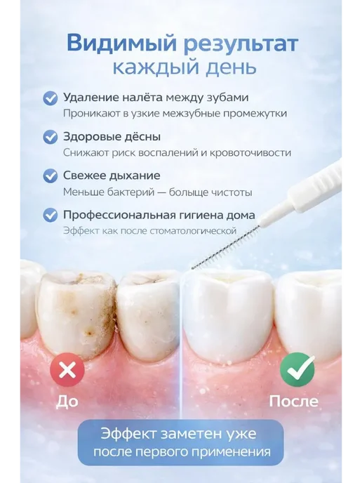 AERAKANY_w Межзубные ёршики для чистки зубов, 30 шт, одноразовые, 30 шт, фото 2