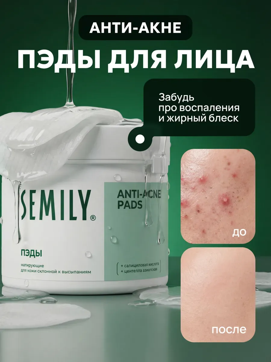 Пэды для лица матирующие от прыщей 32 шт