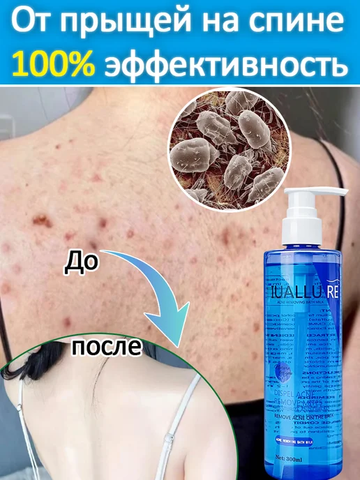 IUALLURE Гель для душа от прыщей на спине 300мл, 300 мл