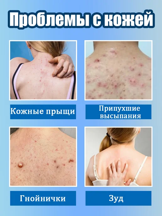 IUALLURE Гель для душа от прыщей на спине 300мл, 300 мл, фото 3