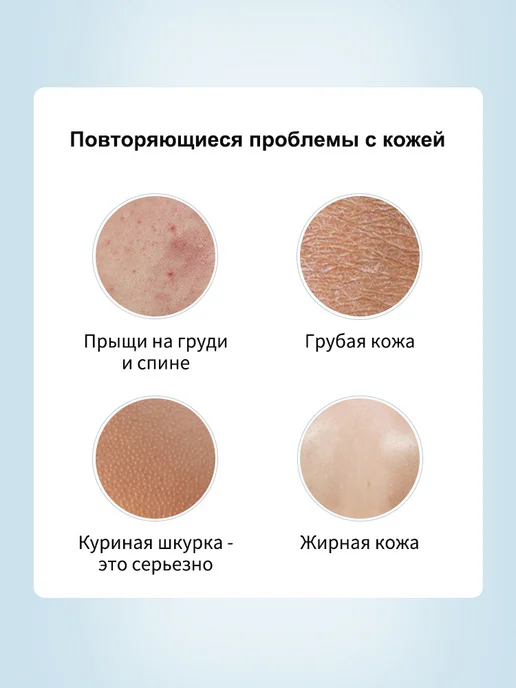 IUALLURE Гель для душа от прыщей на спине 300мл, 300 мл, фото 8