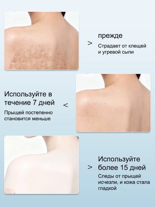 IUALLURE Гель для душа с аминокислотами против зуда и акне, 300 мл, 300 мл, фото 4