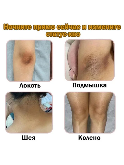 Отбеливающий лосьон для быстрого отбеливания кожи лица и те, вариант, фото 4